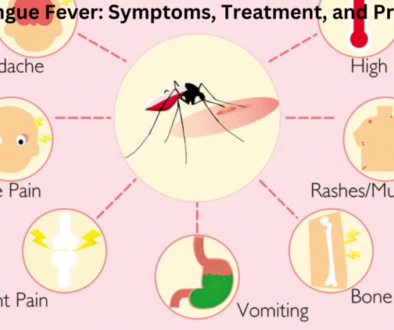 An informative illustration depicting symptoms, treatment, and prevention of Dengue Fever with a central image of a mosquito and surrounding icons representing headache, high fever, eye pain, rashes/muscle pain, bone pain, vomiting, and joint pain.